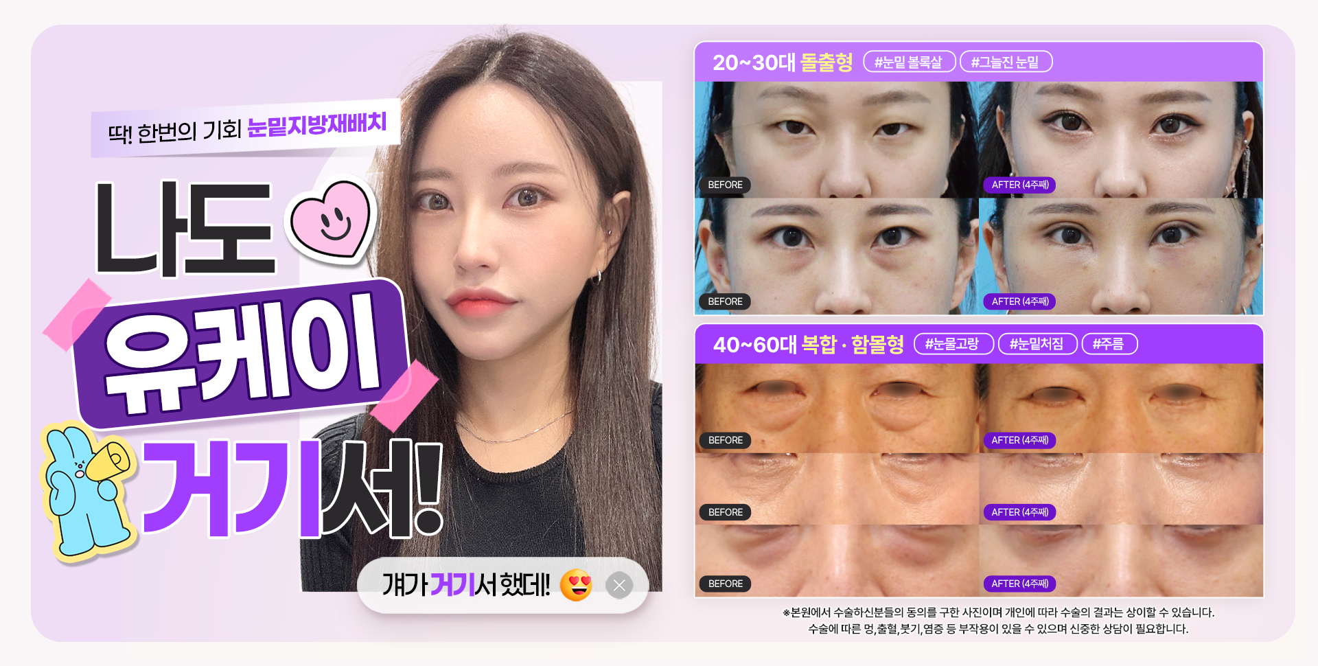 눈밑지